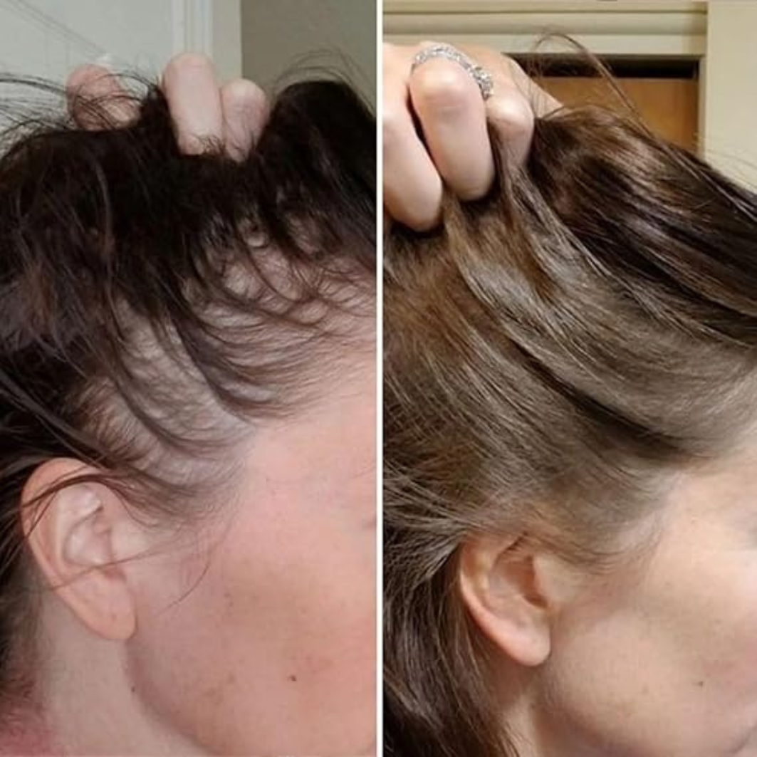 DermaLight PRO™ - geavanceerde therapie voor voller haar