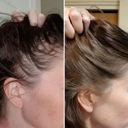 DermaLight PRO™ - geavanceerde therapie voor voller haar