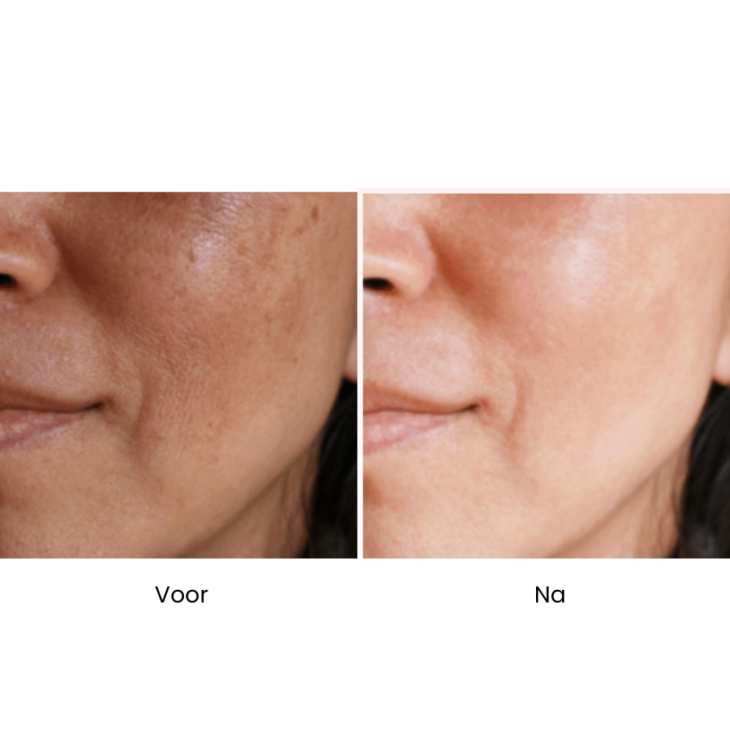 ReLift V-Skin™ 7-in-1