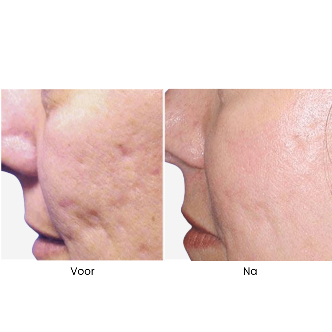 ReLift V-Skin™ 7-in-1